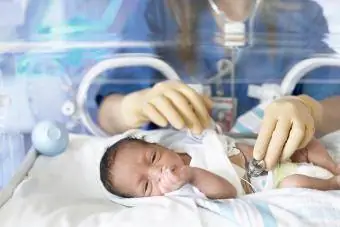 Orvos megvizsgálja az újszülöttet az inkubátorban