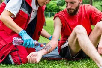 Behandlung von Verbrennungen am Arm