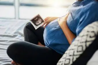 těhotná žena drží ultrazvukové vyšetření