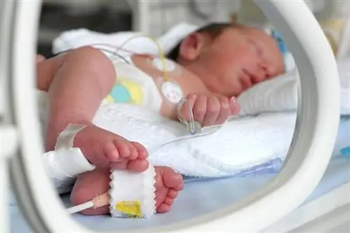 Hva kan du forvente hvis babyen din blir født ved 34 uker