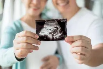 Couple enceinte se sentant heureux de montrer une image échographique