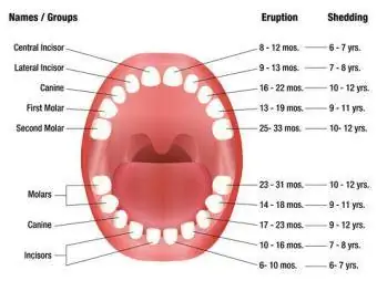 Kort over midlertidige tænder