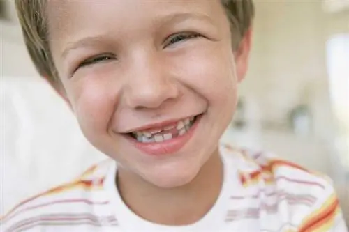 Koliko zob izgubijo otroci? Kaj pričakovati